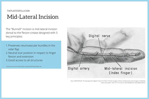 Volar Incisions Bruner Mid Lateral And Others