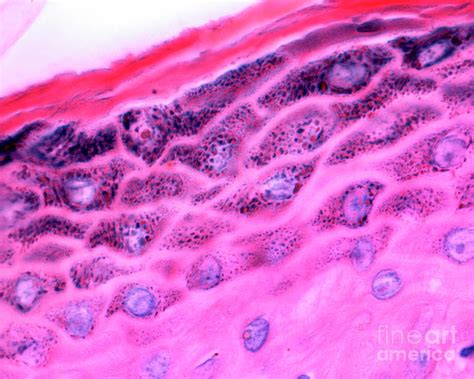 Skin Photograph By Jose Calvoscience Photo Library Pixels