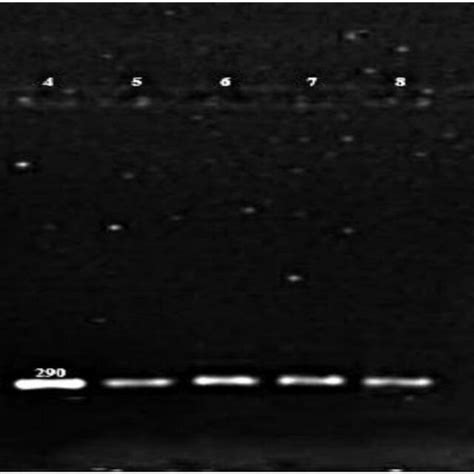 Agarose Gel Electrophoresis Of The Products Of Pcr To Detect 16s Rrna