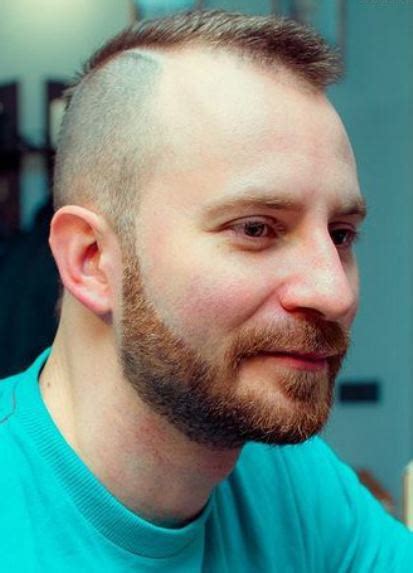 While going the full shave may seem daunting, it looks far better than gradually losing. 15 Best Hairstyles for Balding Men