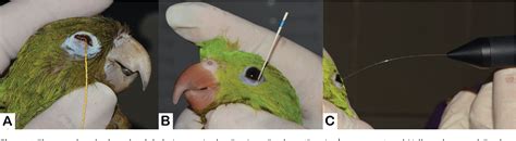 Figure 1 From Reference Values For Selected Ophthalmic Diagnostic Tests