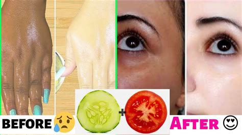How To Get White Skin Naturally At Home Magical Skin Whitening Remedy