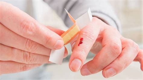 Maybe you would like to learn more about one of these? Primeros auxilios: Cómo curar cortes y heridas