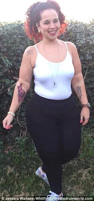 Woman Who Lost 120lbs Raising Money For Loose Skin Surgery Daily Mail