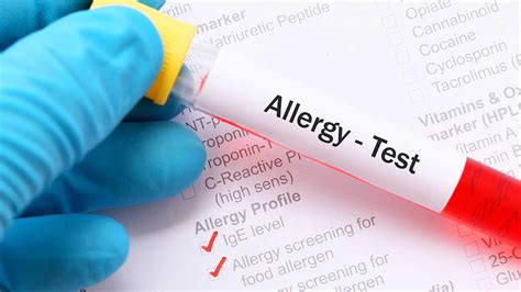 Food Allergy And Intolerance Tests Choice