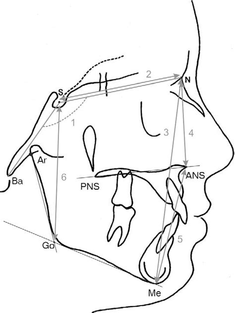 Cranial Base And Vertical Measurements 1 Cranial Angle Nsba 2