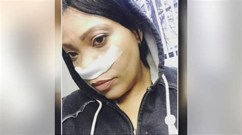 Sinus Cancer Survivor Shares How She Learned Of The Rare Illness And How She Beat It