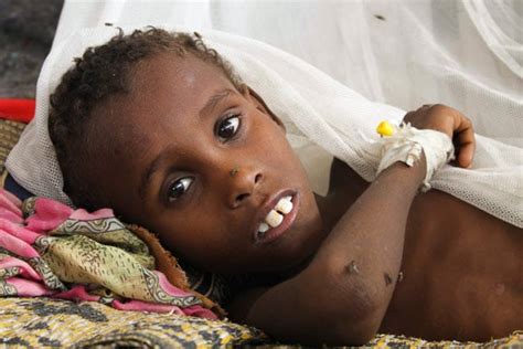 Horn Of Africa Drought Starving Children Suffer During Famine In Somalia