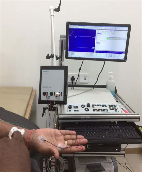 Nerve Conduction Test Centre In Ahmedabad Emg Ncv Test Ansa Clinic