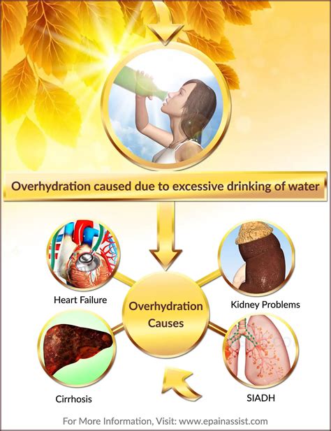 Overhydrationdangers Of Drinking Excess Watersignstreatmentprevention