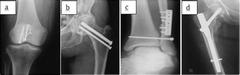 An Overview Of Recent Advances In Designing Orthopedic And Craniofacial