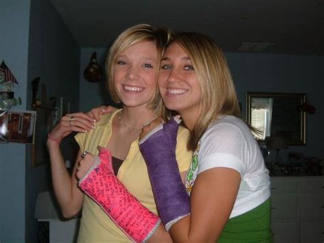Pin By Casterlife On Arm Cast Arm Cast It Cast Photo