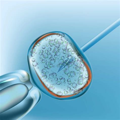 Considering Using Ivf To Have A Baby Heres What You Need To Know