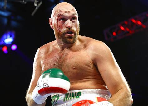 Your online source for boxing news in 2018, updated daily boxing results, schedule, rankings, views, articles, updated 24/7 today and tonight. Photos: Tyson Fury Suffers Severe Cut, Decisions Otto ...