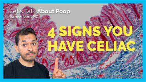 4 Signs Of Celiac Disease Youtube