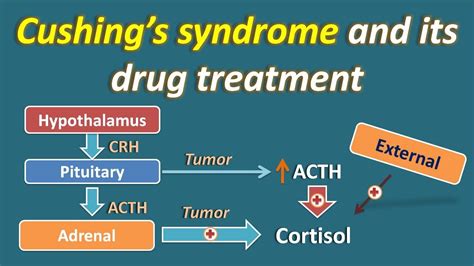 Cushings Syndrome And Its Treatment Youtube