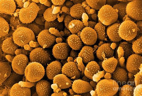 Bean Rust Spores Sem Photograph By Peter Bond Electron Microscope