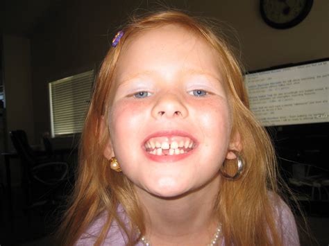 Robb Family Ellie S First Missing Tooth