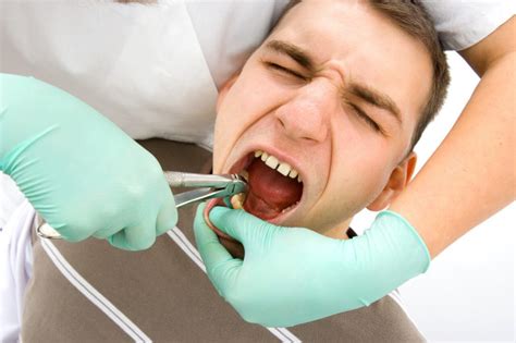 Does Tooth Extraction Hurt What To Expect After The Extraction