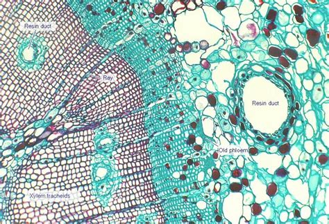 Cross Section Of Xylem And Phloem In Pine Stem
