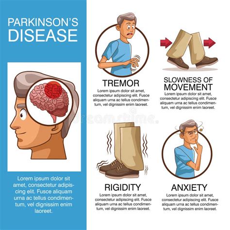 La Maladie De Parkinsons Infographic Illustration De Vecteur