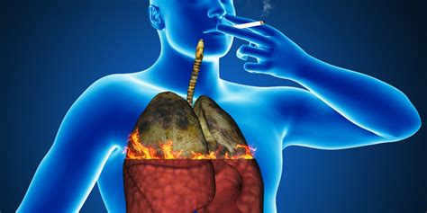 Lung cancer causes and risk factors. Symptoms of Lung Cancer in Men and Risk Factors