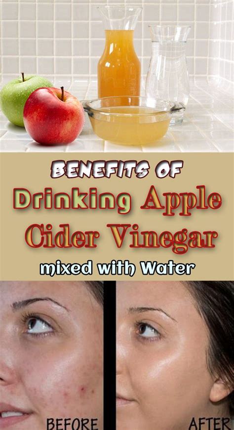 Great Benefits Of Drinking Apple Cider Vinegar Mixed With Water