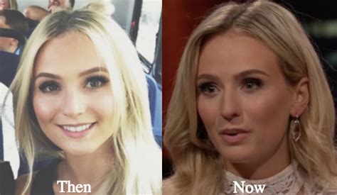 Lauren Bushnell Plastic Surgery Before And After Photos Latest