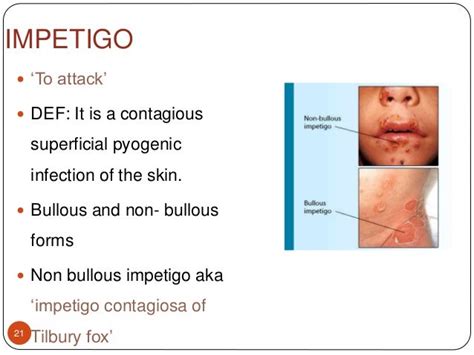 Staphylococcal And Streptococcal Skin Infections