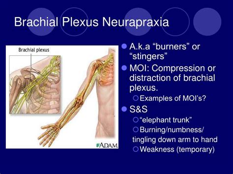 Ppt Cervical Spine Injuries Powerpoint Presentation Id289834
