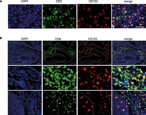 Cd8cd103 Tissue Resident Memory T Cells Convey Reduced Protective