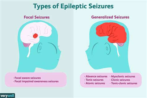 Epilepsy Asiyahchinonso