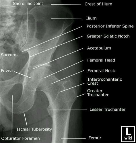 L Pelvis•hip Radiology Schools Radiology Student Radiology Imaging