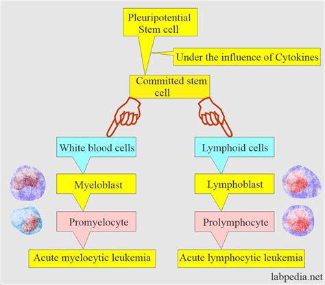 Acute Leukemias And Their Diagnosis Acute Myelocytic And Acute