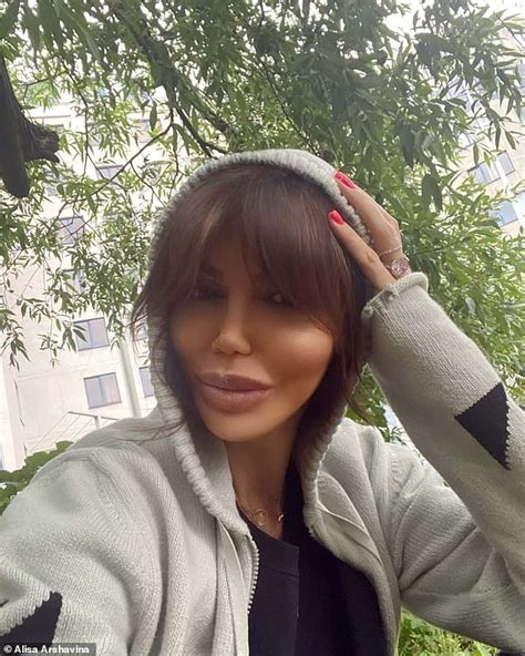 Ex Wife Of Arsenals Andrey Arshavin Denies She Has Suffered Botched