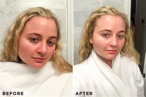 I Tested 6 Of The Best Redness Reducing Skincare Products Redness