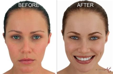 Dermal fillers, microneedling, skin care & more to improve your skin & mood. Semi or Easy Eyebrow Tattoo: Cost And Before After Photos