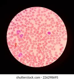 Blood Smear Under Microscope Stock Photo Edit Now