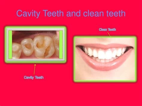 Professional teeth cleanings by a dentist or dental hygienist remove plaque buildup on and between your teeth. PPT - How To Keep Your Teeth Clean PowerPoint Presentation ...