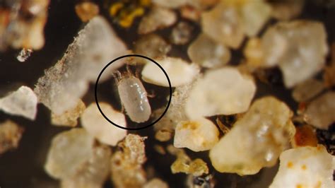 Meet The Dust Mites Tiny Roommates That Feast On Your Skin Kqed