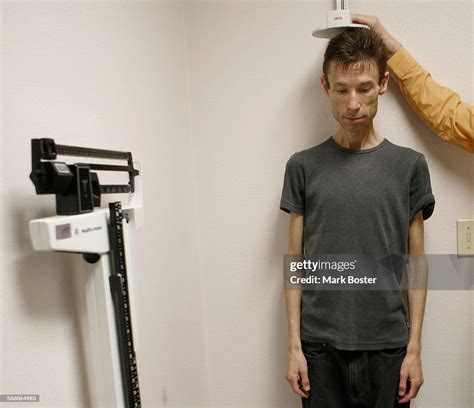 anorexia patient bryan bixler is weighed and measured at the news photo getty images