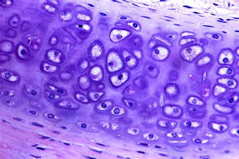 Hyaline Cartilage Stock Image P174 0056 Science Photo Library