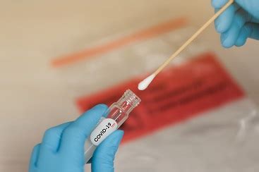 The nasal swab used was the included 94 abbot swab for the gitc arm and the hologic aptima multitest swab otherwise (catalog no. NYC Clinics Add COVID-19 PCR Swab Tests - Mobile Health