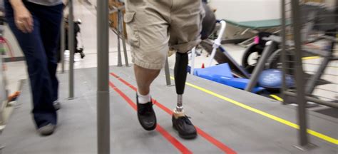 va s ‘grand challenge open source prosthetic limbs for veterans defense one