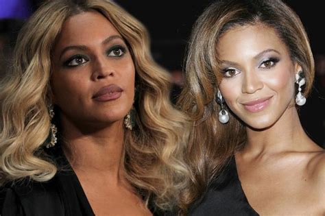 Beyonce Before And After Surgery