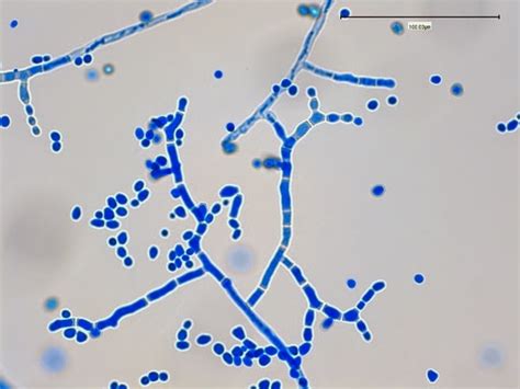 Fun With Microbiology Whats Buggin You Chrysonilia Sitophila