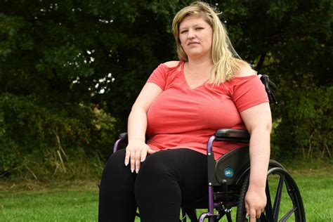 Woman With Massive 42i Breasts Left Wheel Chair Bound After Her Spine Collapses