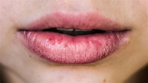What Your Lips Can Indicate About Your Health