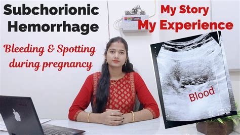 Subchorionic Hemorrhage In Pregnancy 😔early Pregnancyप्रेगनेंसी में