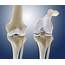 Knee Flexion Anatomy Artwork Photograph By Science Photo Library